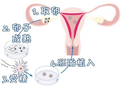 手术室